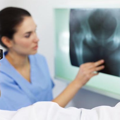 Prtese de quadril: Conhea a cirurgia de artroplastia de quadril