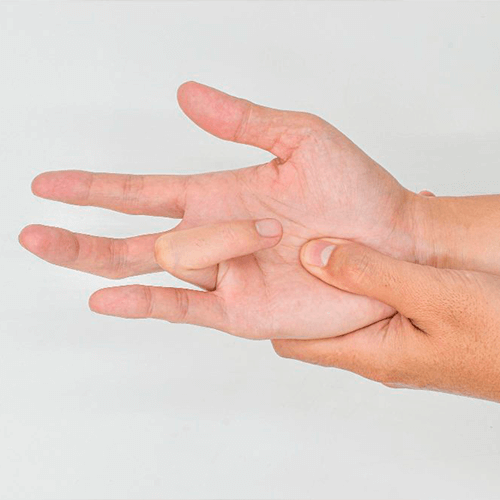 DEDO EM GATILHO - EXISTE ALGUMA SOLU��O?